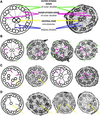 Ultrastructure for the diagnosis of primary ciliary dyskinesia in South Africa, a resource-limited setting